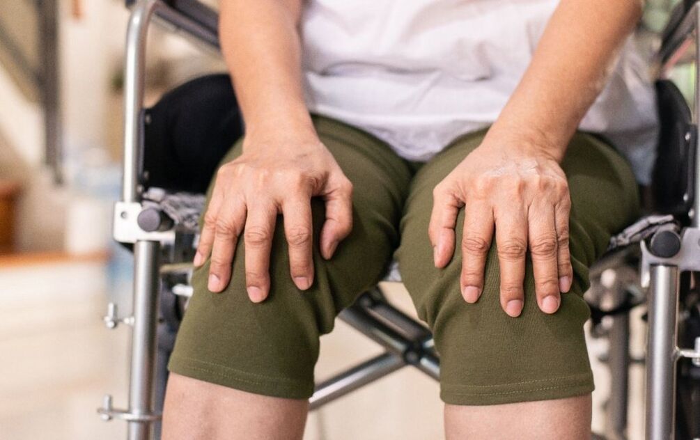 ublažavanje boli u zglobu koljena s artrozom)