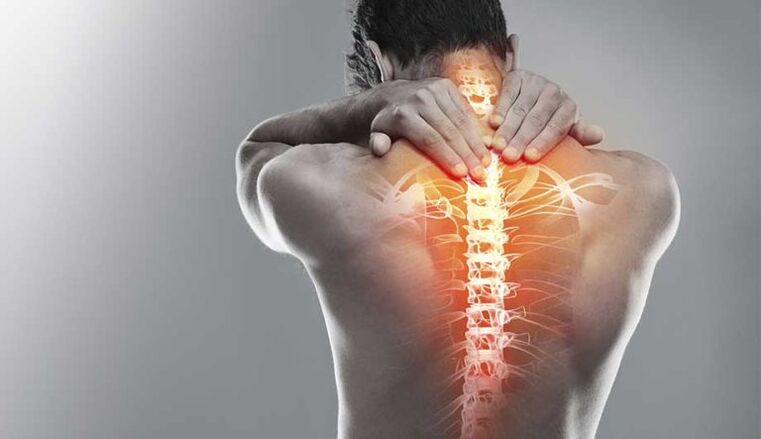 Jaka bol u sredini leđa - znak oštećenja kralježnice