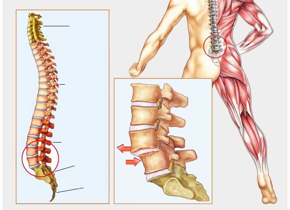 zdravu i bolesnu kralježnicu