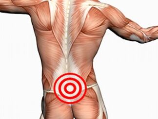 Osteokondroza lumbalne kralježnice