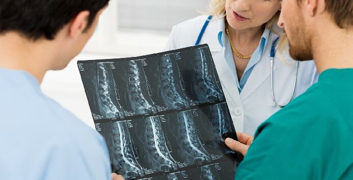 RTG kralježnice kao način dijagnoze osteohondroze